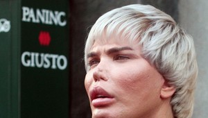 Z Kena sa stala Barbie! Kráľ plastík čaká na operáciu poslednej časti TELA