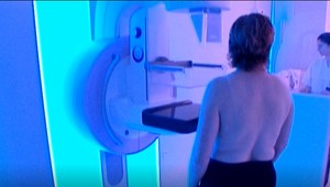 Termín na mamografiu môžete dostať až o dva roky.  Čo robiť v takomto prípade?