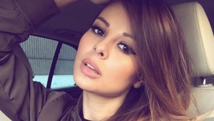 Stojí za krásou Moniky Bagárovej plastika? Speváčka prehovorila!