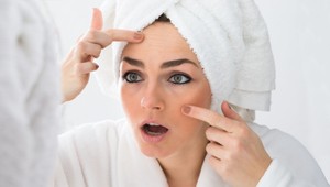 Akné netrápi len tínedžerov. Prezradíme vám recept, ako sa ho navždy zbaviť