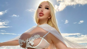 Jessica Alves po rozpustení výplní v tvári: Je to šok!