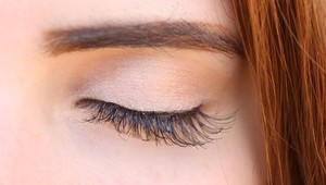 Najpopulárnejšia beauty procedúra Sloveniek: Tento horor by ste nechceli zažiť!