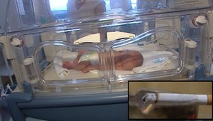 Ste tehotná a fajčíte? Takto vplývajú cigarety na novorodeniatka...