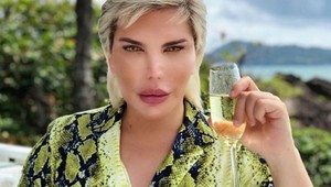 Živý Ken hazarduje so zdravím, lekári dvíhajú varovný prst. Prežije ďalšiu plastiku?