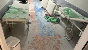 Senior na urgente podpálil lôžka a napadol zdravotné sestry. Zasahovať musela polícia