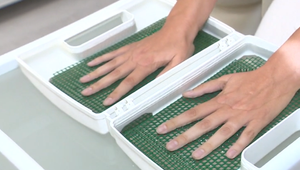 Nadmerné potenie: Problém, ktorý ovplyvňuje komfort aj sebavedomie