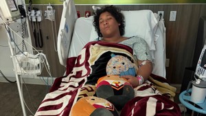 Tínedžer sa po kúpaní nakazil nebezpečnou baktériou. Hrozí mu amputácia končatiny