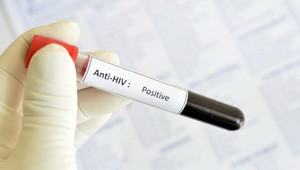 Štatistika vs. realita