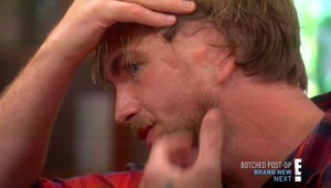 Hudobník Charlie bez ucha! Pomôže mu plastická operácia?