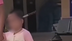 Matka priviezla do nemocnice svoju dcéru (3), ktorá mala v hlave zapichnutý nôž