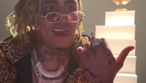 Video: Had sa pri nakrúcaní videoklipu zahryzol do reperovej ruky