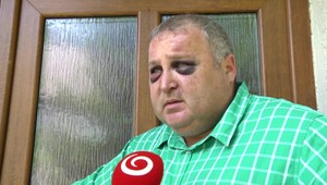 Beštiálny útok na starostu: Skupinka Rómov ho dokopala do bezvedomia