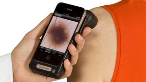 Revolúcia v iPhonoch: Dokážu odhaliť rakovinu!