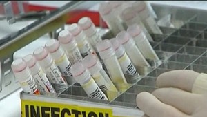 Vedci zo SAV izolovali prvé slovenské kmene vírusu SARS-CoV-2