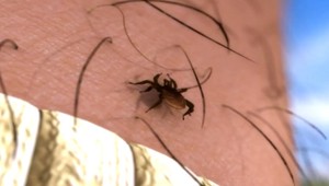 Slovensko má najviac nákaz kliešťovou encefalitídou z potravín! Na čo dať pozor?