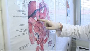 Až 40 percent Slovákov trpí touto nákazou: Máte aj vy INFEKCIU, KTORÁ NIČÍ TRÁVENIE?