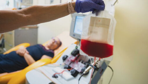 Nová nádej na liečbu rakoviny: Prelomová terapia je už aj na Slovensku