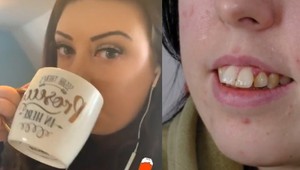 Za nový chrup zaplatila tisíce eur a ľudia ju vysmiali: Aj kôň má krajšie zuby!