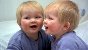 10 zásad, ako sa obliekať a starať sa o oblečenie, ak máte ekzém