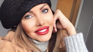 Misska z havarovanej limuzíny Borisa Kollára: Pred vylepšeniami by ste ju nespoznali!