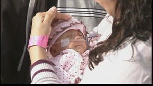 Lekári zachránili najmenšie dieťa. Hovoria o zázraku