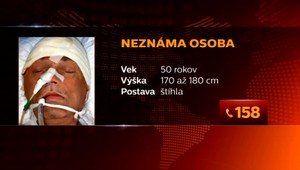 Muža našli s ťažkými zraneniami v bezvedomí. Jeho identita je neznáma