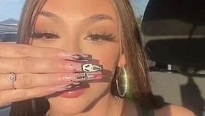 Hejteri jej píšu, že veľký nos jej úplne ničí tvár: Nikdy nepôjdem pod nôž, odkazuje kráska