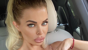 Vzdala sa poznávacieho znamenia! Kačacie pery Silvie Kucherenko su PREČ!