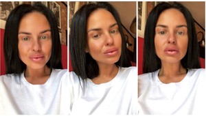 Mirka radí všetkým ženám: Chcete si napichať pery? Len pod TOUTO podmienkou!