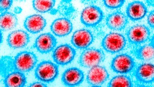 Britským vedcom sa podarilo "zlikvidovať" vírus HIV