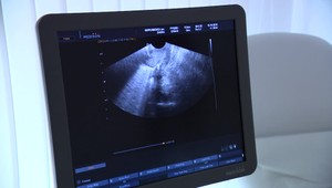 Legálne interrupcie v Poľsku opäť stúpajú. V štatistikách vedie duševné zdravie