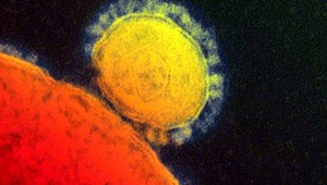 MERS zabije každého tretieho človeka, z Arábie sa dostal do Ameriky