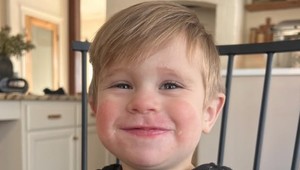 Na synčeka spadlo doma zrkadlo. Najskôr sa zdal byť v poriadku, krátko na to zomrel