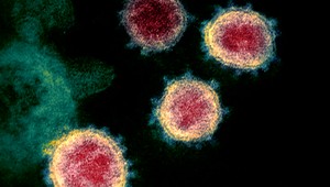 Kmeň Pirola Covid: Aké sú príznaky nového podvariantu Omicronu?