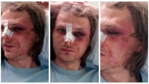 Prešovčan: Zmýlil som si byt, zbili ma policajti