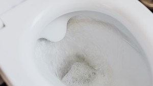 Ako vyzerá váš moč? Jeho farba a vzhľad môže signalizovať viaceré choroby