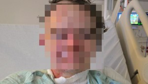 Mladík utrpel vážne popáleniny po útoku kolegu. Vylial naňho žeravý olej