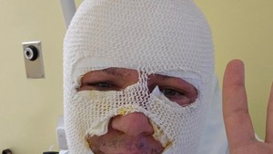 Bývalý poslanec NR SR Miroslav Žiak utrpel popáleniny 1. a 2. stupňa