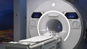 Muža vtiahol prístroj magnetickej rezonancie. Do miestnosti vošiel s retiazkou na krku