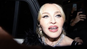 Madonna opäť pod paľbou kritiky: Jej vyhľadená tvár je ľuďom na smiech