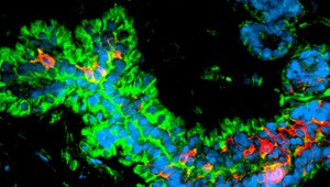 Vedci našli nový spôsob pestovania kmeňových buniek