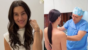 Katka Kadlecová si dala spraviť PRSIA: Detailné zábery z OPERÁCIE, uvidíte takmer všetko!