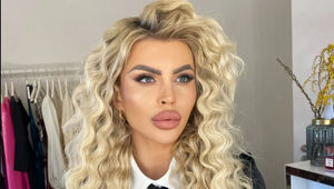 Slovenská kráľovná plastík sa pustila do žien: Ak ste také prirodzené, tak sa o seba prestaňte starať...