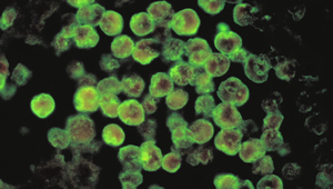 Vo vzorkách z kúpaliska Vadaš hygienici nepotvrdili prítomnosť améby Naegleria fowleri