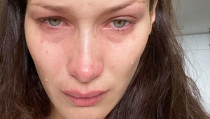 Jedna z najkrajších žien sveta šokovala priznaním v slzách! Má len 25 rokov a TENTO obrovský problém!