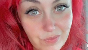 Žena ukázala svoje telo po tom, ako schudla vyše 100 kíl: Nie je to hnusné, je to normálne