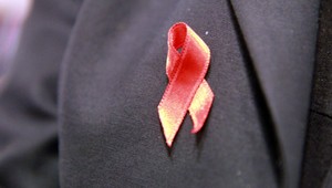 HIV sa môže šíriť aj nedostatkom tolerancie