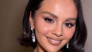 Selena Gomez prekvapila zmenou: Naozaj podstúpila drastickú plastickú operáciu?