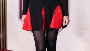 Šokujúca premena slávnej modelky: Nohy ako paličky, ale čo tá zmenená a opuchnutá tvár?