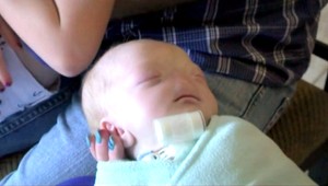 Matka bábätka bez nosa: Nič mi nezabráni zverejňovať jeho fotografie